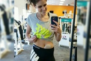Exercise routine with a stoma