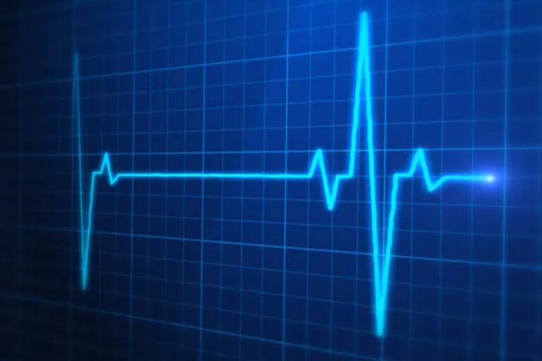 cardiomyopathy