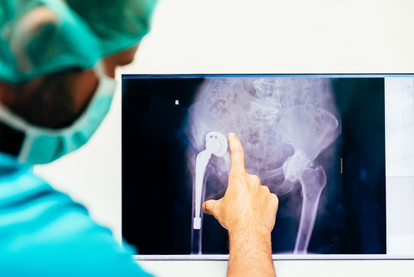 Hip replacement phyisotherapy