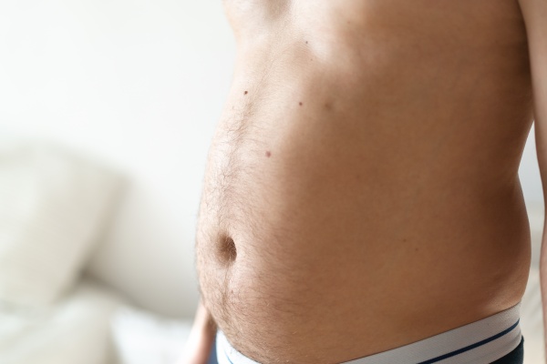 overweight man with visceral fat
