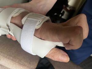 Spasticity physiotherapy services